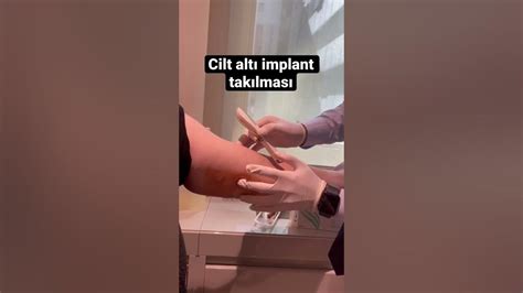 Cilt Altı İmplant