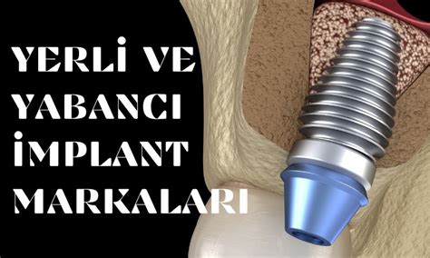 İmplant Markaları