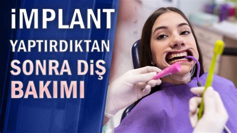 İmplant Nedir