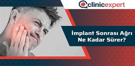 İmplant Sonrası Ağrı